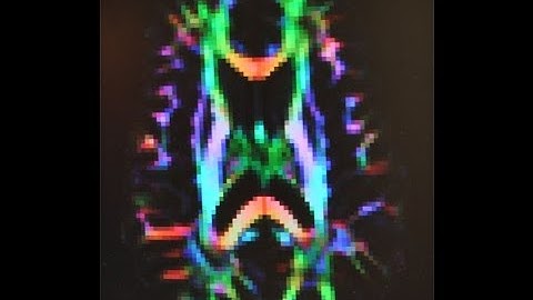 Brain Imaging