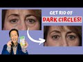 How Do I Get Rid of Under-Eye Circles Without Surgery? - Dr. Anthony Youn