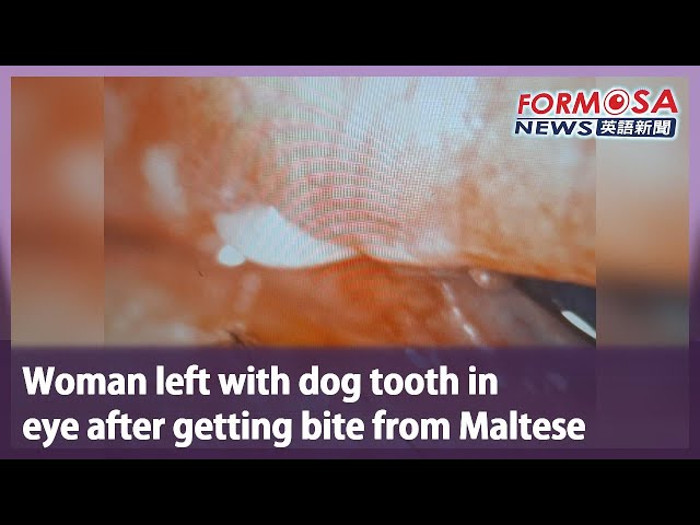 Woman left with dog tooth in eye after getting bite from Maltese｜Taiwan News