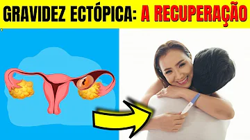Como fica a trompa depois de uma gravidez ectópica?