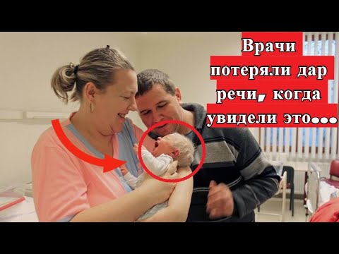 Врачи Были Ошарашены, Когда Увидели Голову Этого Новорожденного! Малыш С Седыми Волосами!