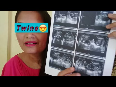 वीडियो: किनारे पर जुड़वाँ बच्चे