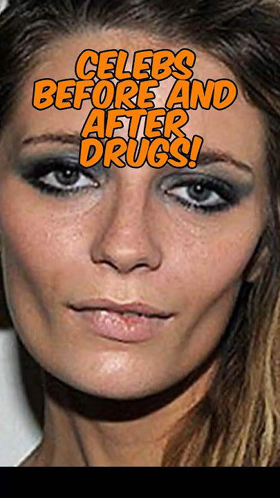 Celebs Before and after Drug Addiction
