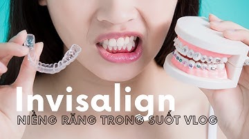 Niềng răng trong suốt Vlog - Kinh nghiệm & Lần đầu tiên