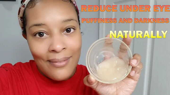 Say Goodbye To Under Eye Circles And Darkness