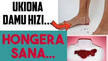 JE, Damu ni DALILI Ya MIMBA CHANGA? / #mimba #bloodduringpregnancy