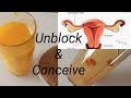 How to UNBLOCK FALLOPIAN TUBES Naturally & Conceive Fast | Natural Treatment to Unblock Tubes