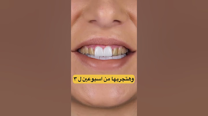 خدعة مرعبة هتستغرب انها موجوده للاسنان #تبييض_الاسنان #خلطات_الاسنان #وصفات  #يوتيوب  #اكسبلور  تجم