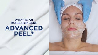 What is an IMAGE skincare advanced peel?