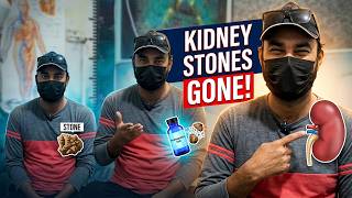 Kidney Stone Removed in Just 15 Days? | Kidney Stone Patient Review | Kidney Stone Treatment