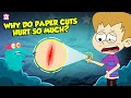 Why do paper cuts hurt so much  how does your brain respond to pain  the dr binocs show