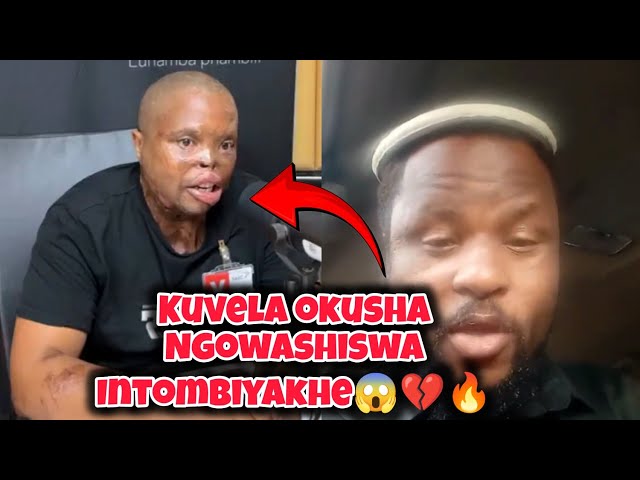 Ngeke ukholwe kuvela okusha ngowashiswa i Acid😱||ingoba uyakhotha i Gqenene😰😱🔥 class=