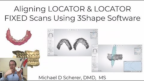 Aligning Multiple Scans Using Reference Denture Technique and 3Shape - LOCATOR and LOCATOR FIXED