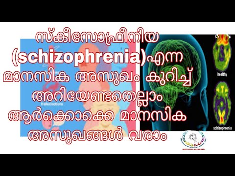 schizophrenia Disorder, സ്കീസോഫ്രീനിയ എന്ന മാനസിക അസുഖം ആർക്കൊക്കെ വരാം