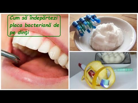 Video: Placa Pe Dinți: Un Defect Cosmetic Sau O Amenințare La Adresa Sănătății?