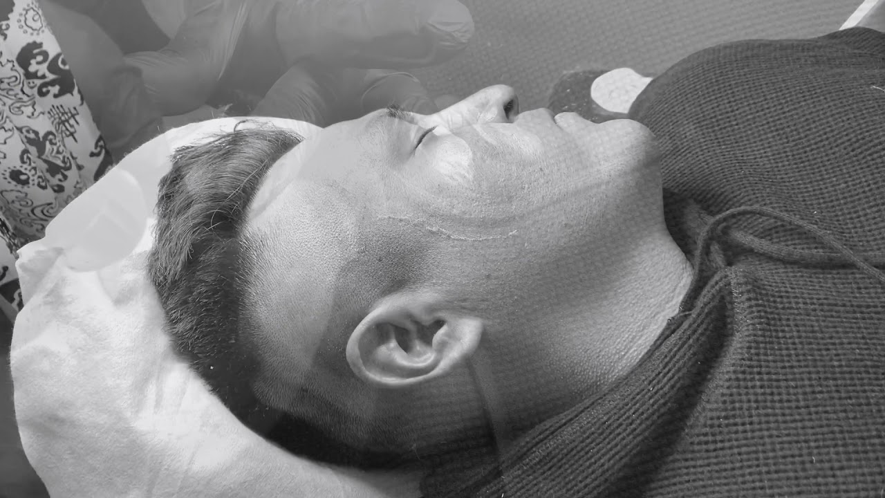 Dermaplaning Albuquerque New Mexico