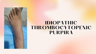 Idiopathic Thrombocytopenic Purpura