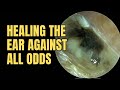 Healing The Ear Against All Odds