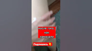 Бальзам ЖИВОКОСТ - самый эффективный от болей в СУСТАВАХ