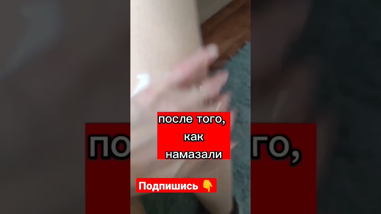 Бальзам ЖИВОКОСТ - самый эффективный от болей в СУСТАВАХ