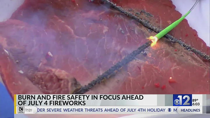 How to prevent fireworks-related injuries