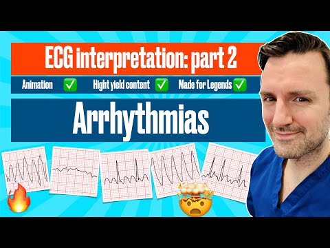 Yeni başlayanlar için EKG yorumu: Bölüm 2 - Aritmiler 🔥🔥🔥🔥 animasyon, kriterler ve açıklama