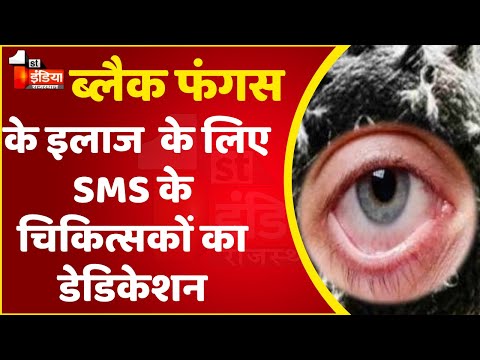 SMS अस्पताल में Black Fungus के मरीजों की सर्जिकल मैराथन, चरक भवन में चल रहा 24 घंटे के लिए OT