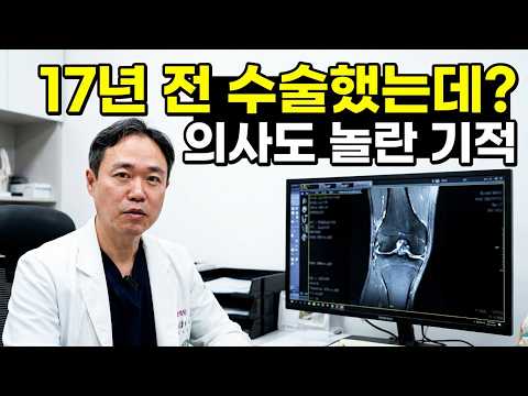 반월상 연골 절제술 후 17년, 무릎 관절염은 ? - 신재활 무릎 점검