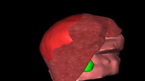 Liver Deformation Simulation | SOFA Framework