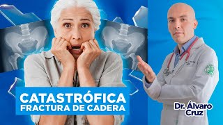 Lo que NADIE TE CUENTA🤫 sobre la CATASTRÓFICA FRACTURA de CADERA😨💔