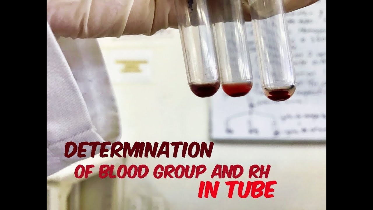 Determination of blood group and Rh in tube - YouTube