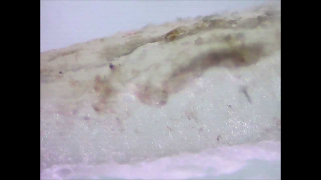 Fingernail Clippings Under A Microscope Disgusting Mustsee Youtube