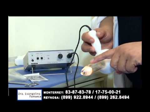 cirugia de hemorroides con laser en monterrey cirugia de hemorroides con laser en monterrey