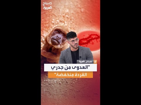 أخصائي الطب العام نور جابر: نسبة العدوى من جدري القردة منخفضة مقارنة بكورونا