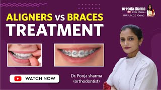 Aligners vs Braces Treatment ||Which is best ? Orthodontic in Agra, India || Dr Pooja Sharma