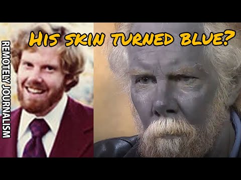 How did this man turn blue?