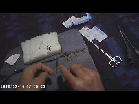 ქირურგიული კვანძები და მარყუჟები - ვიდეო 9