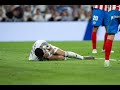 Kylian Mbappe injured vs Girona after catching an elbow