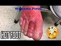 Hot Foot Pinto?  Dr. Gilmore Strikes Again