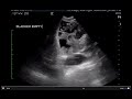 Advanced abdominal ultrasound