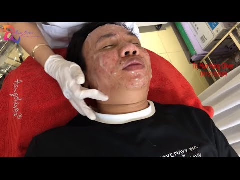 Acne Skin Care With Bubbling Gel For Đức | Hang Oliver | Part 