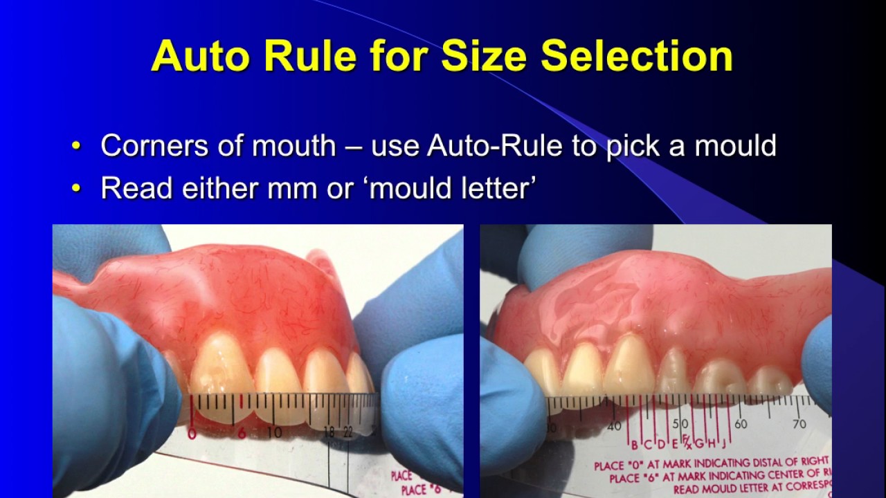 Selecting Denture Teeth (revised)
