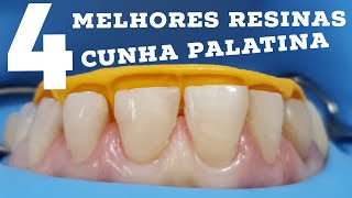 🔴4 MELHORES RESINAS🥇 PARA A CUNHA PALATINA PARA FACETAS EM RESINA🤩🤩🤩🤩🤩🥇