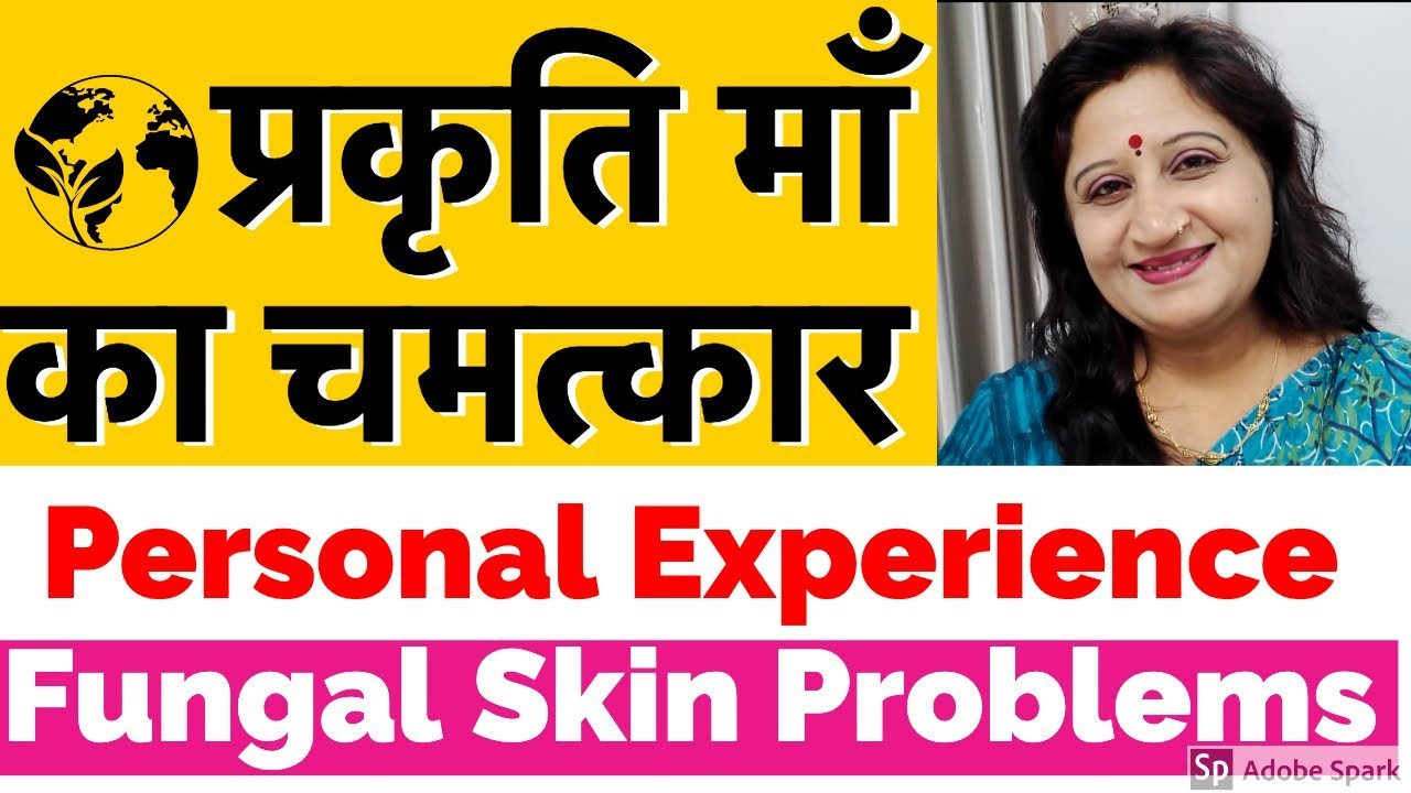 Psoriasis, Eczema, RingWorm All In One Treatment Fungal Infection