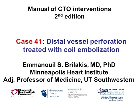 Case 41: Manual