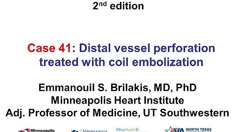 Case 41: Manual of CTO interventions - Distal vessel perforation treated with coil embolization