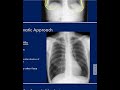 شرح محاضرة Chest Radiology (الجزء الرابع)