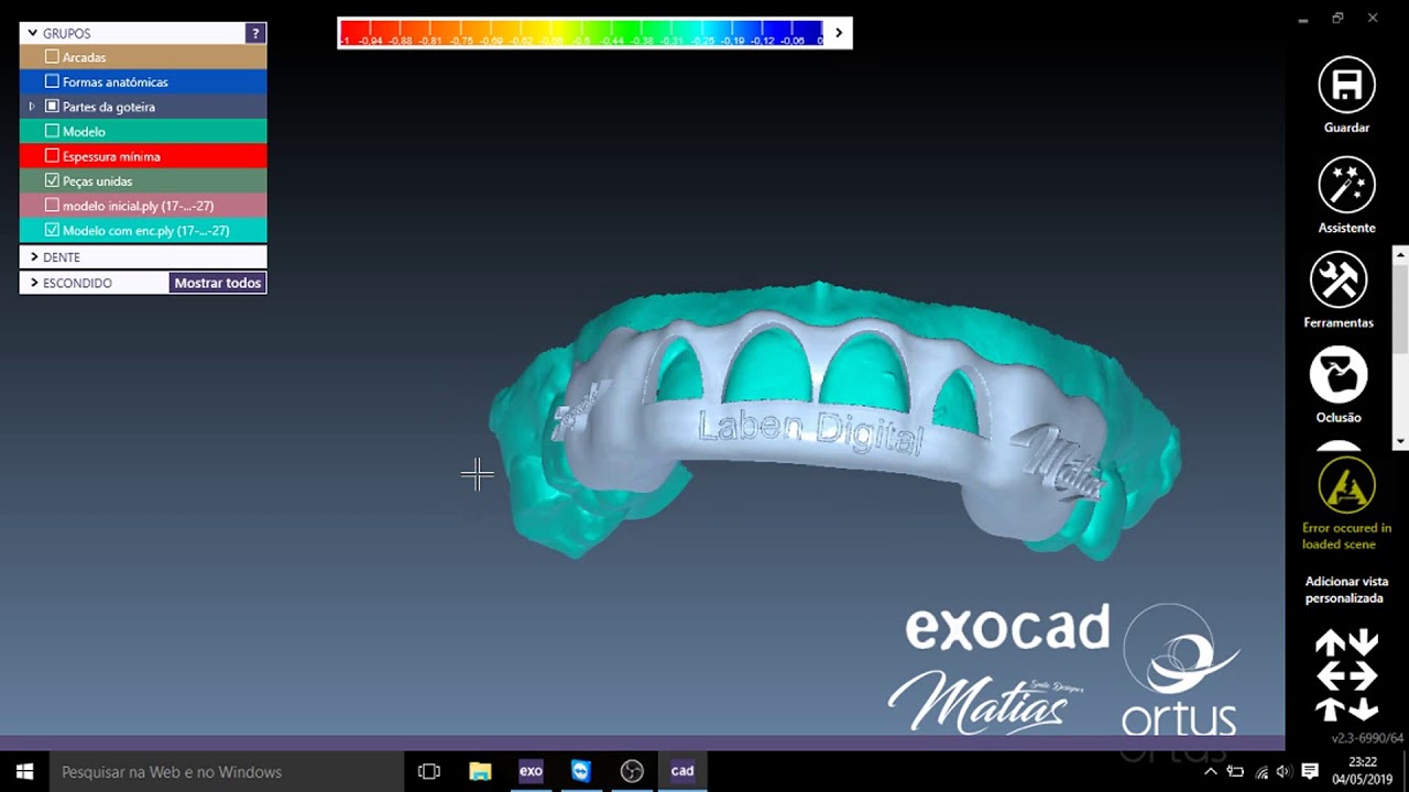 Guia Perio exocad Matera 2.3 YouTube