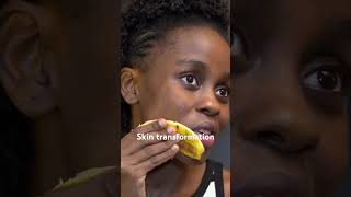 Skin transformation