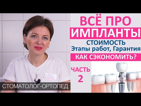 Импланты (часть 2): стоимость имплантации, цена составных частей импланта, гарантия,дешевые импланты